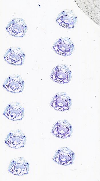 Media type: image; Special Collections 3102   shows specimen_part histological serial section;  Description: Whole slide scan, SC-3102, slide 20;